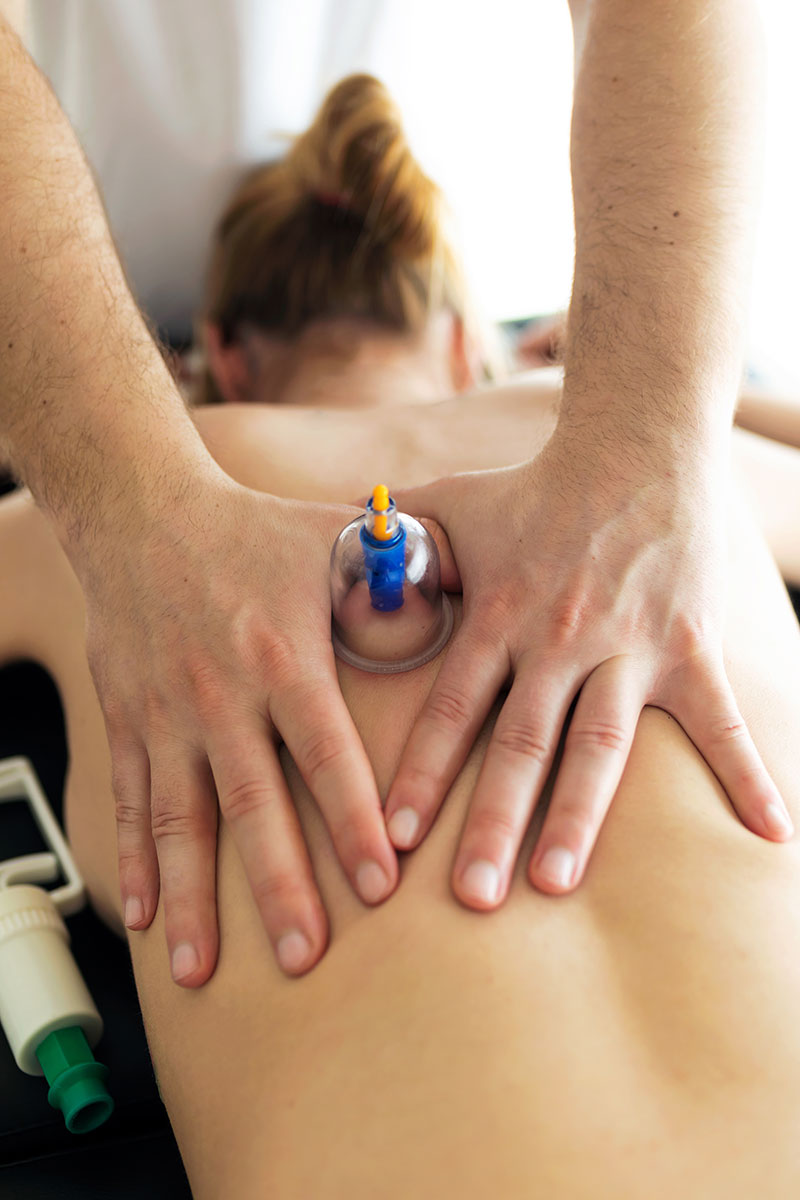 Cupping Therapy in Aylesbury