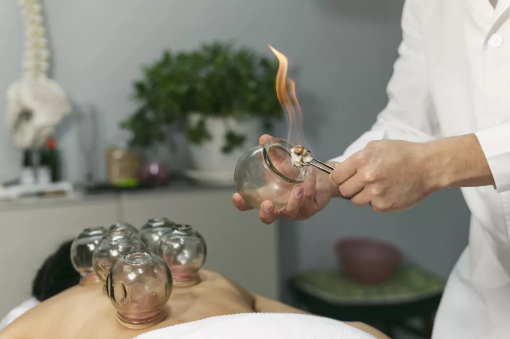 Cupping Therapy in Buckingham