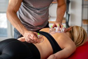 Cupping Therapy